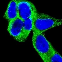 CRMP-5 Mouse Monoclonal Antibody