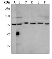 RANBP9 Mouse Monoclonal Antibody