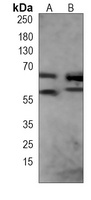 FUBP3 Mouse Monoclonal Antibody