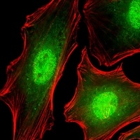 FUBP3 Mouse Monoclonal Antibody