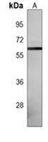 Estrogen Receptor beta Mouse Monoclonal Antibody