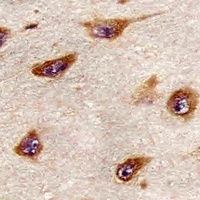 ATG4A Mouse Monoclonal Antibody