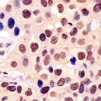 BANP Mouse Monoclonal Antibody