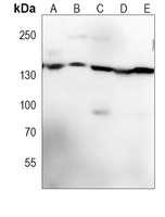 RAPTOR Mouse Monoclonal Antibody
