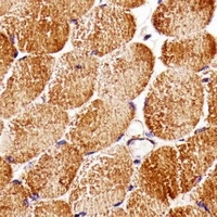 RAPTOR Mouse Monoclonal Antibody