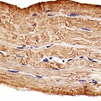 GLK Mouse Monoclonal Antibody
