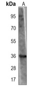 MYO18B Mouse Monoclonal Antibody