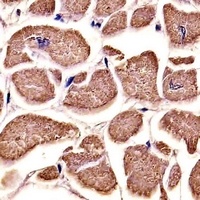 MYO18B Mouse Monoclonal Antibody