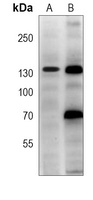 TRK C Mouse Monoclonal Antibody