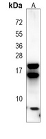 REG3 gamma Mouse Monoclonal Antibody