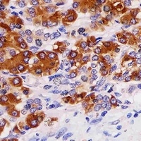 REG3 gamma Mouse Monoclonal Antibody