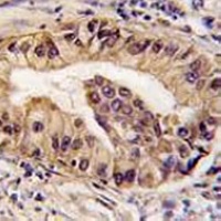 ATG16L1 Mouse Monoclonal Antibody
