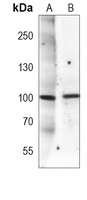MUSK Mouse Monoclonal Antibody