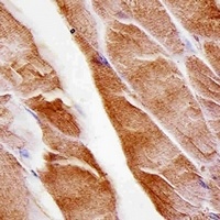 MUSK Mouse Monoclonal Antibody