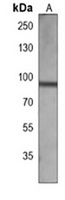 TRK B Mouse Monoclonal Antibody