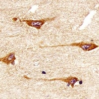 TRK B Mouse Monoclonal Antibody