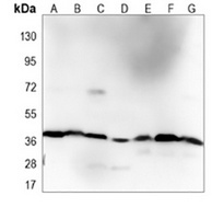p38 Antibody