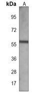 Alpha-internexin Mouse Monoclonal Antibody