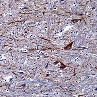 Alpha-internexin Mouse Monoclonal Antibody