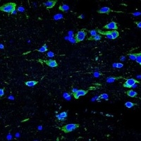 Alpha-internexin Mouse Monoclonal Antibody
