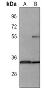 HUR Mouse Monoclonal Antibody