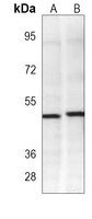 PDK2 Mouse Monoclonal Antibody