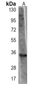 GNMT Mouse Monoclonal Antibody