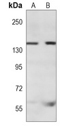 KANK1 Mouse Monoclonal Antibody