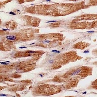 KANK1 Mouse Monoclonal Antibody