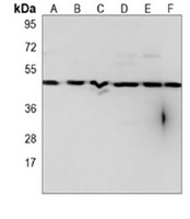 IRF3 Mouse Monoclonal Antibody