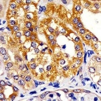 IRF3 Mouse Monoclonal Antibody
