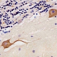 CaMK2 beta Mouse Monoclonal Antibody