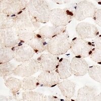 PPAR alpha Mouse Monoclonal Antibody