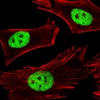 PPAR alpha Mouse Monoclonal Antibody