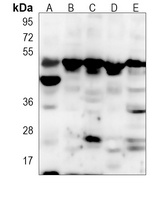 MKK1 Mouse Monoclonal Antibody