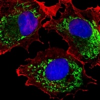 ALDH6A1 Mouse Monoclonal Antibody