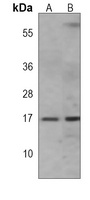 IFITM3 Mouse Monoclonal Antibody