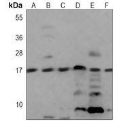 UBC9 Mouse Monoclonal Antibody