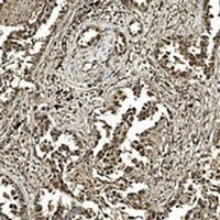 SUMO1 Mouse Monoclonal Antibody