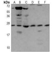 RAB11A Mouse Monoclonal Antibody