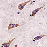 RAB11A Mouse Monoclonal Antibody