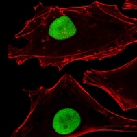SUMO2 Mouse Monoclonal Antibody