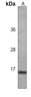 IL-2 Antibody