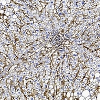 CD81 Antibody