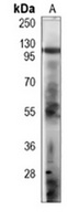 EPHA5 Mouse Monoclonal Antibody