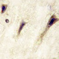 EPHA5 Mouse Monoclonal Antibody
