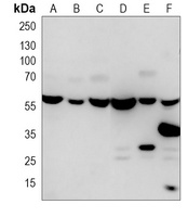 RAD23B Antibody