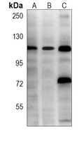 Hexokinase 2 Mouse Monoclonal Antibody
