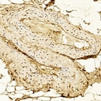 Hexokinase 2 Mouse Monoclonal Antibody