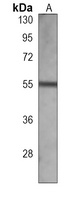 ALDH3A2 Mouse Monoclonal Antibody